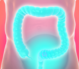 Optimizing the Care of Refractory Metastatic CRC